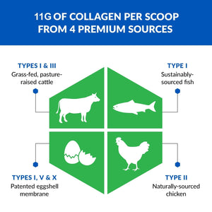 BioTrust Ageless Multi Collagen Peptides Powder – 5 Types (I, II, III, V, X) – Chocolate Collagen Powder for Women & Men – Hydrolyzed Protein – Grass Fed Beef, Fish, Chicken, Eggshell Membrane BioTrust buy supplements Au