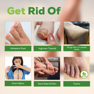 FOOT CURE Tea Tree Oil Foot Soak with Epsom Salt - Best Toenail Fungus Treatment, Athletes Foot & Softens Calluses - Soothes Sore & Tired Feet, Fungal Toe, Foot Odor Scent, Spa Pedicure (Pack of 2) FOOT CURE buy supplements Au