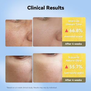 Suplement XIANUI Deep Vitamin Radiance Serum - 5% Niacinamide + TXA + Vitamin C - Brightening & Hydrating Face Serum with Ceramide & Triple Hyaluronic Acid - VelvetGlow USA