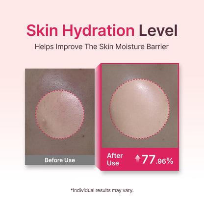 Starting Rose Galactomyces Essence Toner, Hydration & Glow (5.07 fl oz)