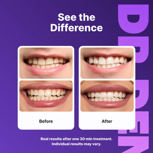 Suplement ​DRDENT Purple Teeth Whitening Strips 21 Treatments - Safe for Enamel - Non Sensitive Teeth Whitening - VelvetGlow USA