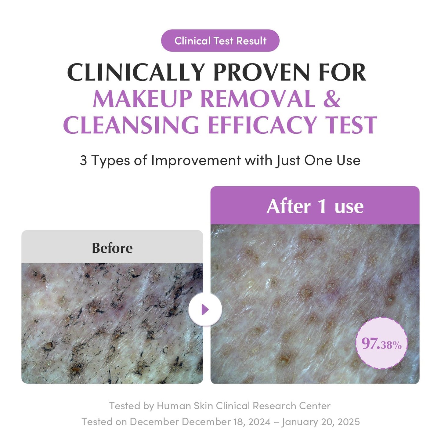 EQQUALBERRY Purple Rice Pore Smoothing Cleansing Oil – Deep Cleansing for Pores & Blackheads | Korean Oil Cleanser for Face & Makeup Remover