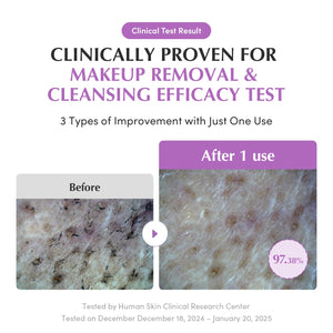 Suplement ​EQQUALBERRY Purple Rice Pore Smoothing Cleansing Oil – Deep Cleansing for Pores & Blackheads | Korean Oil Cleanser for Face & Makeup Remover - VelvetGlow USA