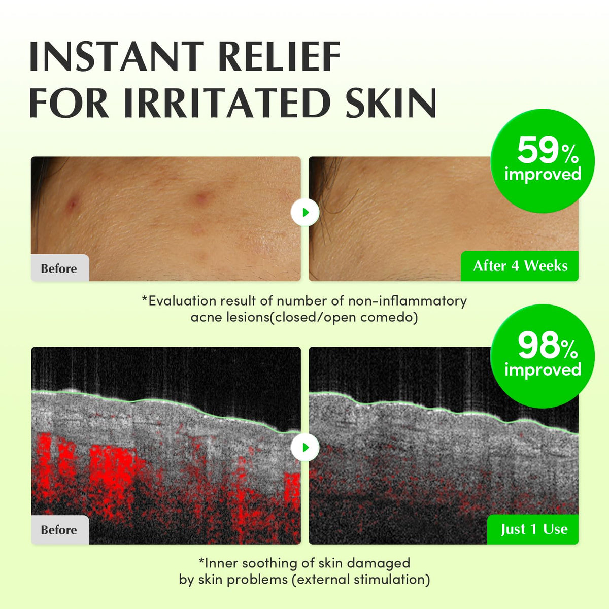 Suplement ​EQQUALBERRY Aloe PDRN Calming Toner, for Sensitive, Instant Relief & Cooling | Non-Comedogenic & Fungal Acne Safe, Skin Barrier Repair - VelvetGlow USA