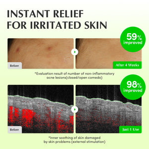 Suplement ​EQQUALBERRY Aloe PDRN Calming Toner, for Sensitive, Instant Relief & Cooling | Non-Comedogenic & Fungal Acne Safe, Skin Barrier Repair - VelvetGlow USA