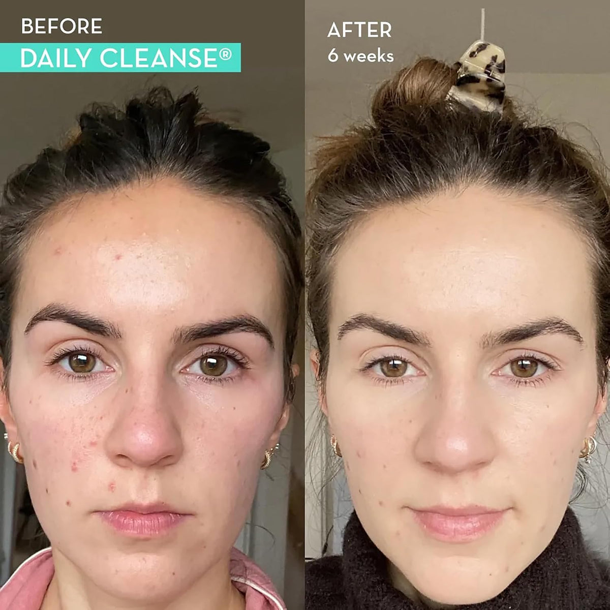 HUM Private Party, Daily Cleanse, Vaginal Probioitcs, Detoxifying Herbs for Women's Health