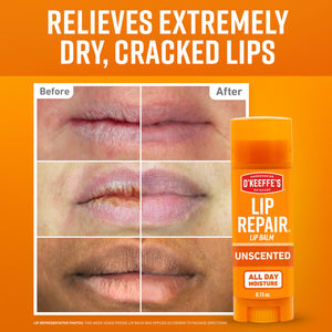 O'Keeffe's Lip Repair Unscented Lip Balm for Dry, Cracked Lips - Stick (3 Pack) - Moisturizer for Very Dry Lips O'Keeffe'sBuy Supplements Australia
