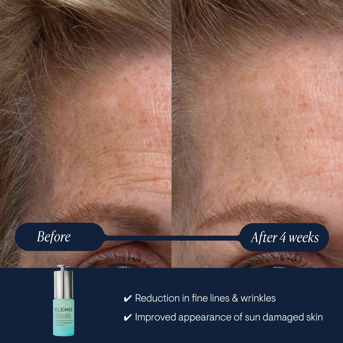ELEMIS Pro-Collagen Renewal Serum 15ml, Gentle Retinol Alternative for Smoothing Fine Lines & Wrinkles
